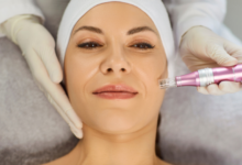 Why Microneedling in Tucson Is Trending for Skin Rejuvenation