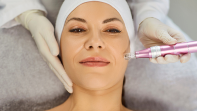 Why Microneedling in Tucson Is Trending for Skin Rejuvenation