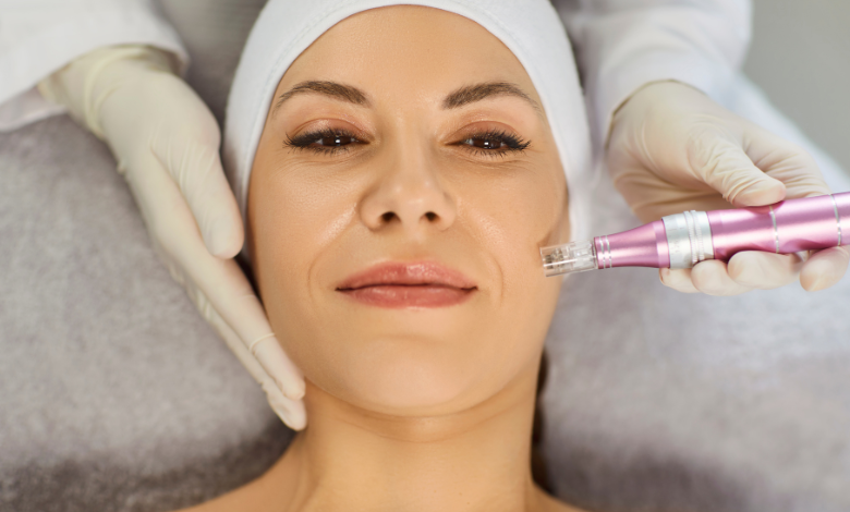Why Microneedling in Tucson Is Trending for Skin Rejuvenation
